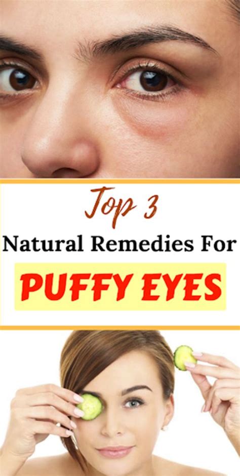 TOP 3 Natural Remedies For Puffy Eyes | Remèdes naturels, Yeux gonflés, Remede