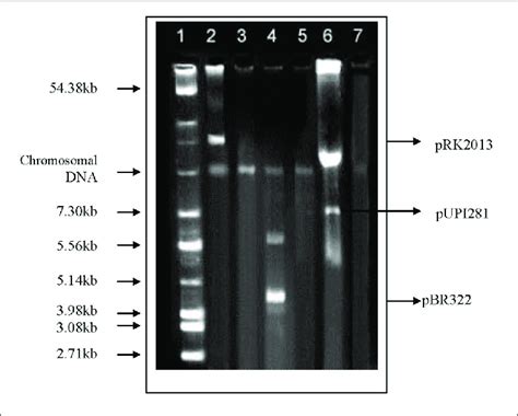 plasmid in bacteria diagram