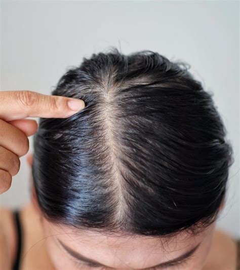How Do You Treat A Dry Scalp And Oily Hair?