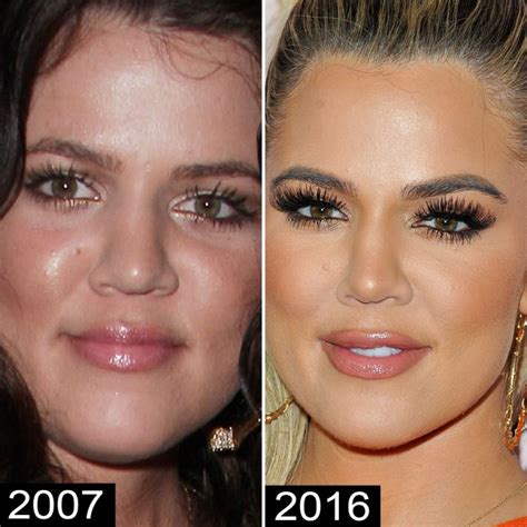 Khloé Kardashian Before and After: See Her Complete Transformation!