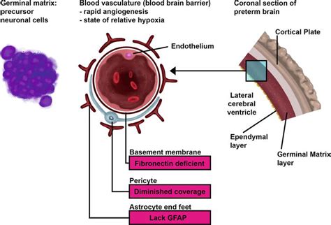 Germinal Matrix Brain Anatomy