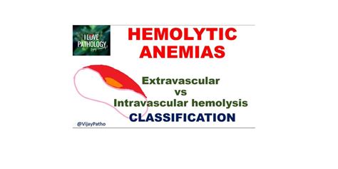 HEMOLYTIC ANEMIA - Extravascular vs Intravascular hemolysis ...