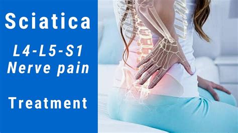 L4-L5-S1 Sciatica Pain | Sciatic nerve pain | Treatment of sciatica (Leg Pain) - YouTube