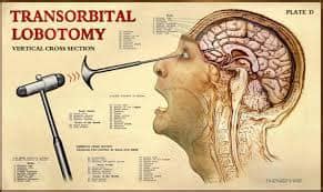 lobotomy The procedure was simple.... - Goddi's Oddities