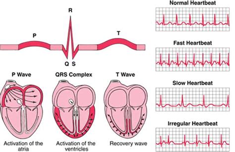 Medical Videos ppt and Lecture Notes: ECG Interpretation