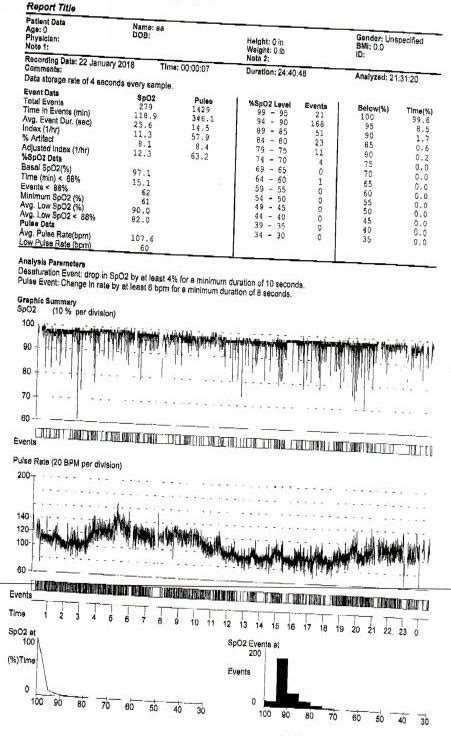 Overnight oximetry demonstrating normal baseline oxygen saturation and... | Download Scientific ...