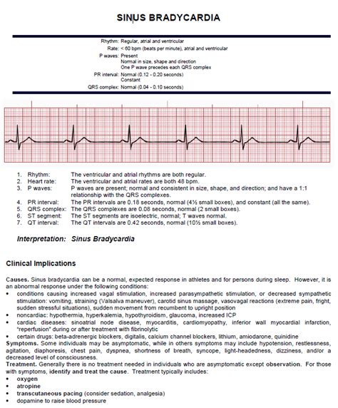 Sinus Bradycardia