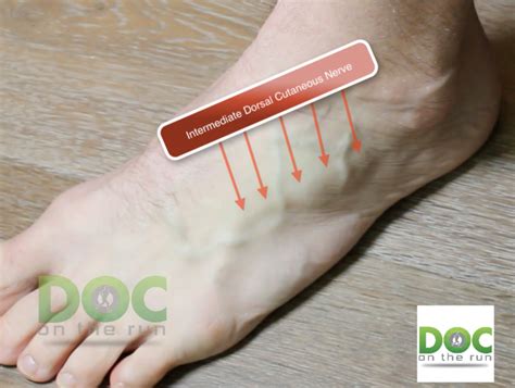 #676 I rolled my ankle and foot hurts here. What is it? - DOC