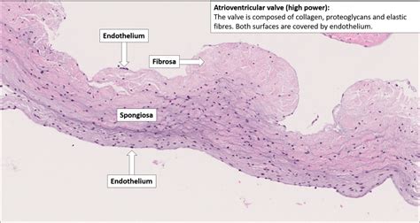 Atrioventricular valve with chordae tendineae – Normal Histology – NUS ...