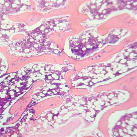 Cancellous bone, also called trabecular or spongy bone, H.E. Stain, human histology slides ...