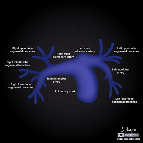 Pulmonary Artery Segmental Anatomy