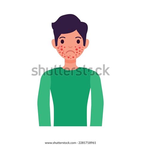 Boy Sufferering Red Rashes Allergy Symptom Stock Vector (Royalty Free ...