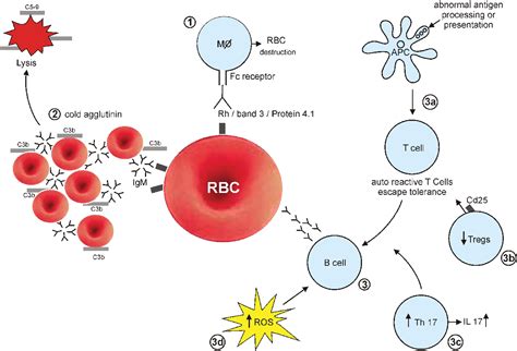 Figure 1 from Autoimmune hemolytic anemia: current understanding of pathophysiology | Semantic ...