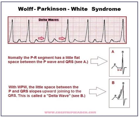 Randy's EKG Website