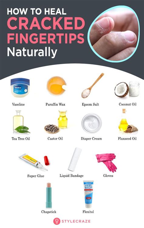 Natural Home Remedies For Cracked Fingertips | Cracked fingertips, Dry ...