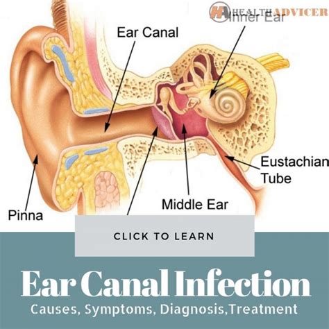 Ear Canal Infection: Causes, Picture, Symptoms, And Treatment