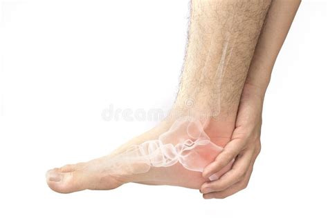 Foot bones pain stock photo. Image of osteoporosis, inflame - 121938056