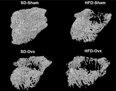 Examples of 3D images for bone microarchitecture. | Download Scientific Diagram