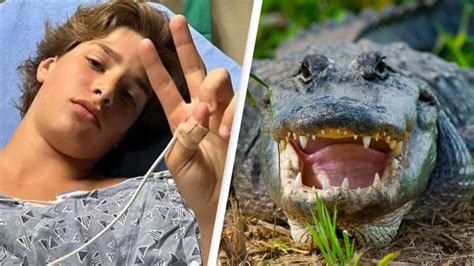 Florida teen shares horrifying story after being attacked by alligator ...