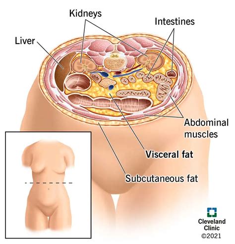 Visceral Fat and Metabolic Health - Metabolic Health