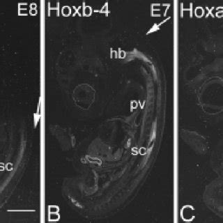 Some Hox genes are regionally restricted in their expression within the... | Download Scientific ...