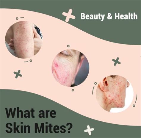 WHAT ARE DEMODEX MITES AND WHY DO THEY MATTER?