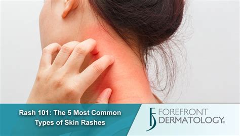 Rash 101: The 5 Most Common Types of Skin Rashes - Forefront Dermatology