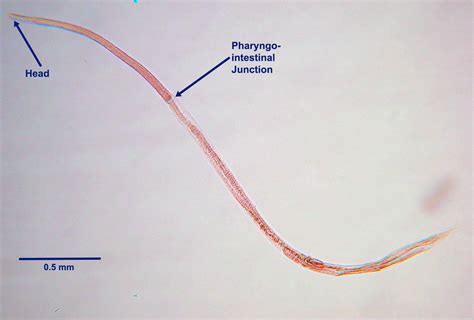 Strongyloides stercoralis - Learn About Parasites - Western College of ...