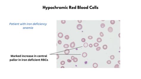 Red Cell Staining (Color) • The Blood Project