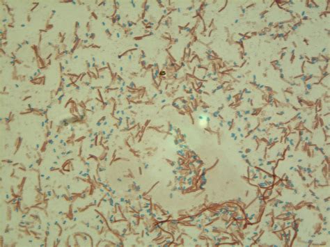 Staphylococcus Aureus Acid Fast Stain