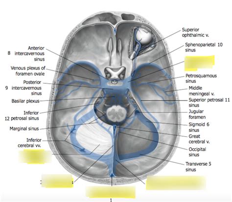 Right Transverse Sinus