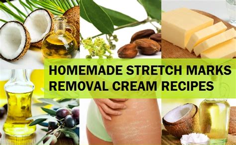 4 Homemade Natural Stretch Marks Removal Cream Recipes