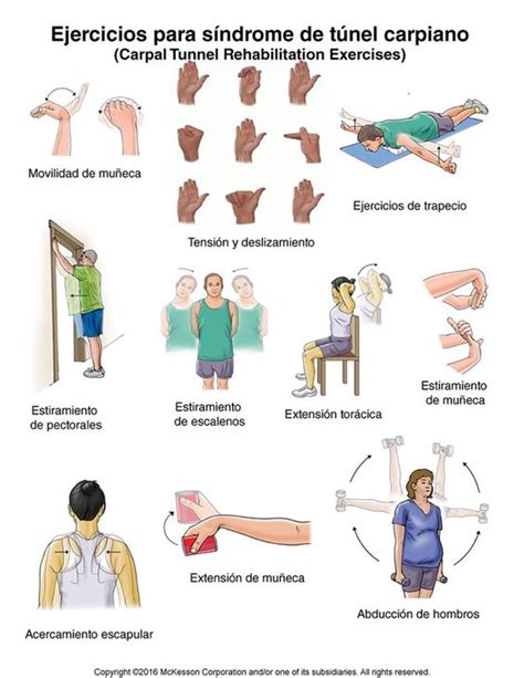 ﻿ABC DEL SÍNDROME DEL TÚNEL CARPIANO – Clínica Uros