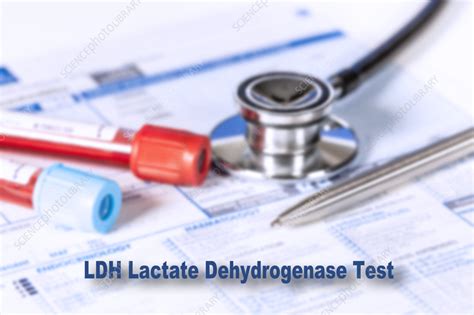 Lactate dehydrogenase test, conceptual image - Stock Image - F037/1176 - Science Photo Library