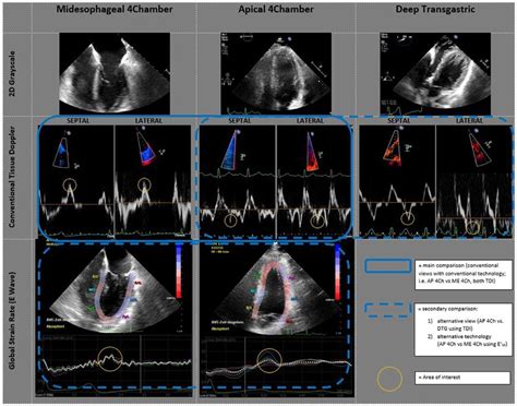 Comparison of mitral annular velocities in different echocardiography ...