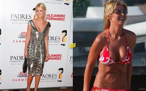 17 Celebrities Who Looked Better When They Weren’t ‘Skinny’ - ScoopWhoop