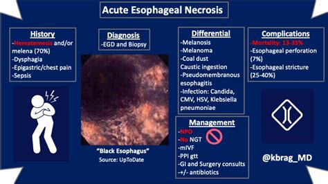 Acute Esophageal Necrosis History: Hematemesis and/or ... | GrepMed