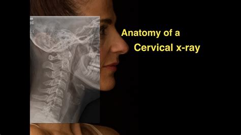 Anatomy Of A Cervical X Ray From X Ray Anatomy Watch Video Mypornvid ...