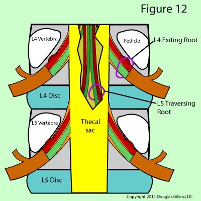 Learn all about lumbar spine anatomy from a world-renowned Spine Expert ...