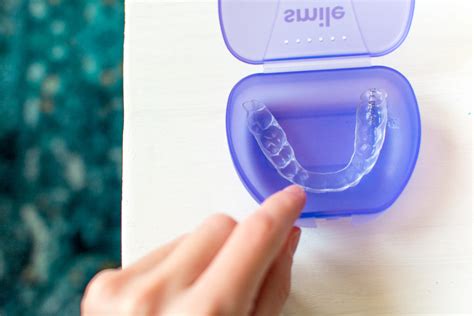 Teeth Talk: Smile Direct Club Invisible Aligners