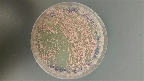 Identifying the Genetic Source of a Mutation in Halobacterium salinarum – ISB High School ...