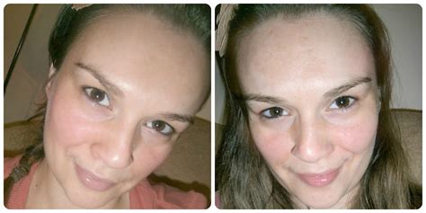 beautiful me plus you: My first Glycolic peel - and it didn't hurt at all...