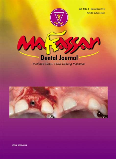 Kegagalan estetik pada gigi tiruan cekat | Makassar Dental Journal