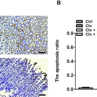 TUNEL staining. Epithelial apoptosis in gastric mucosa was evaluated by... | Download Scientific ...