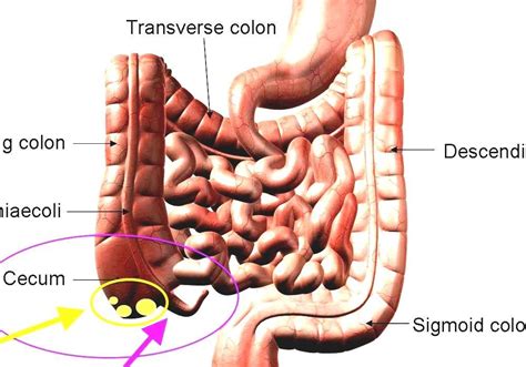 Vermiform Appendix - Human Appendix Pain