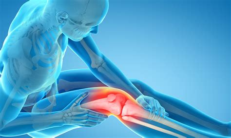 Beyond pain relief: Total knee replacement surgery | NIH MedlinePlus Magazine