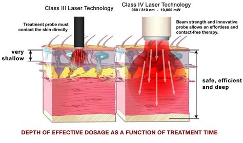 WHAT IS CLASS IV LASER THERAPY