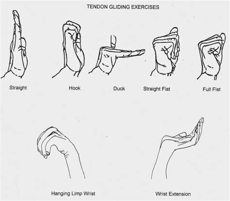 11 best Carpal tunnel exercises images on Pinterest | Carpal tunnel ...