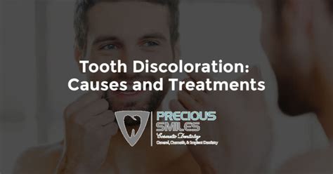 Tooth Discoloration: Causes and Treatments - Cosmetic Dentistry in Miami Beach, FL - Precious Smiles