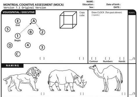 Karlawish: President Trump's cognitive exam provides insufficient data ...